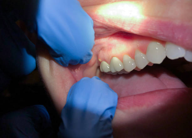 Best Pediatric Emergency Dentist in Ruthers, CA