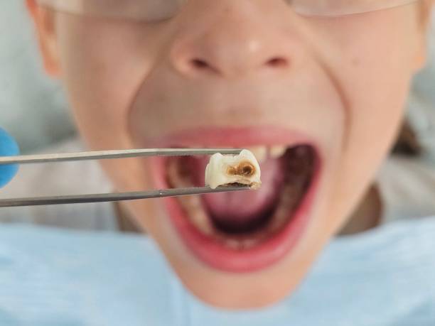 Best Same-Day Emergency Dental Services in Ruthers, CA