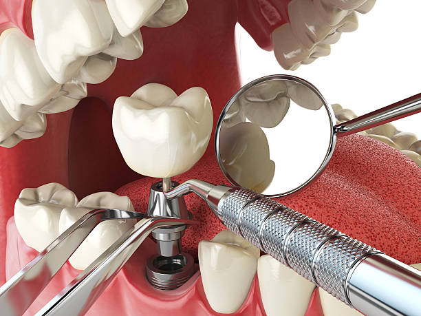 Best After-Hours Dental Trauma Care in Ruthers, CA